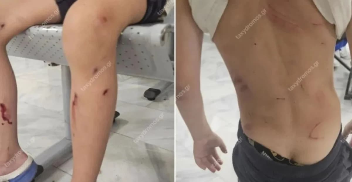 Volos: Streunende Hunde greifen 7-Jährigen an – Im Krankenhaus