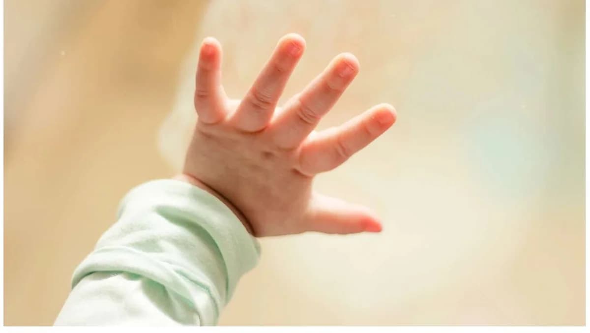 Bebé de 9 meses con moretones en el Hospital Infantil – Investigación por abuso