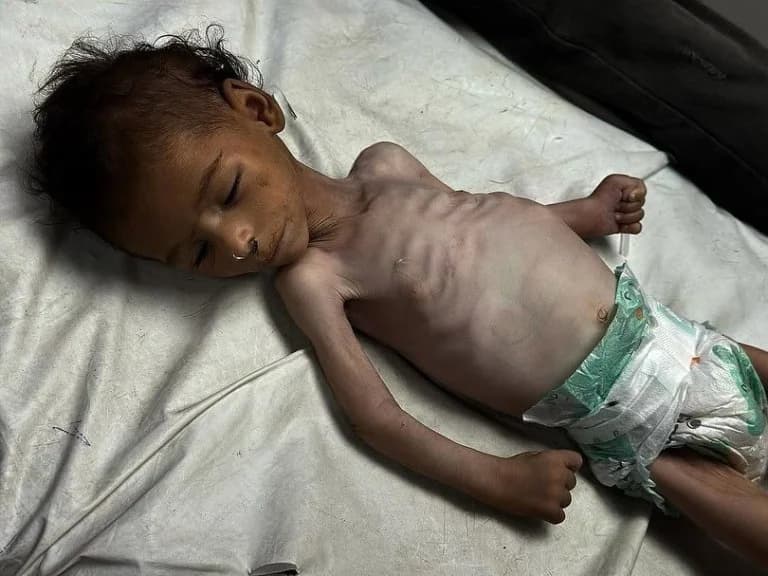 Gaza: Hunger und Pläne für eine „Riviera“ von israelischer Rechtsaußen