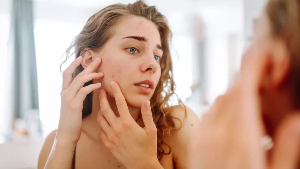 Κίνδυνοι από DIY μάσκες προσώπου με σκόρδο και πιπέρι