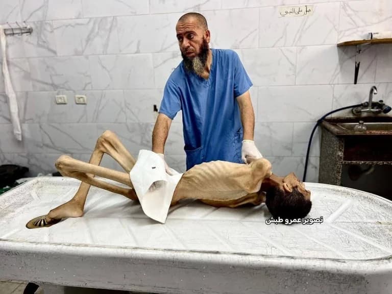 עזה: רק 1.5% מהאדמות החקלאיות ניתנות לעיבוד, סכנת רעב מרקיעה שחקים