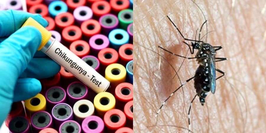 Virus Chikungunya: Posible propagación en Chipre - El Dr. Voniatis expresa su preocupación