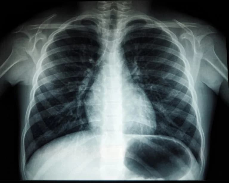 Air Pollution Linked to Lung Cancer via DNA Mutations