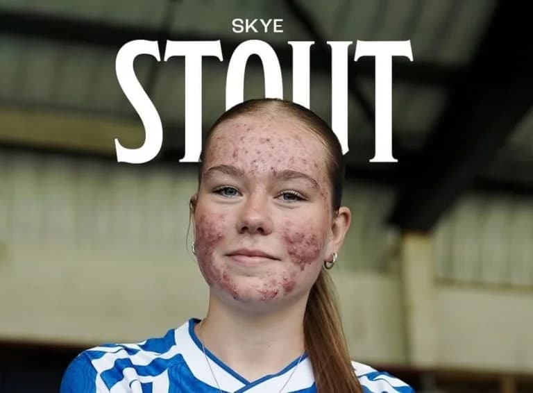 Skye Stout: Η 16χρονη απαντά στο διαδικτυακό μπούλινγκ με γκολ