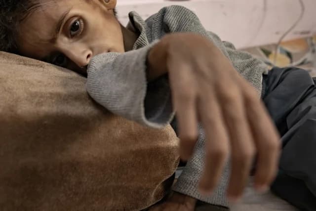 UN: At Least 21,000 Children Disabled by Gaza War
