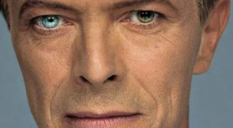 Explaining Eye Color: Genetics and Melanin