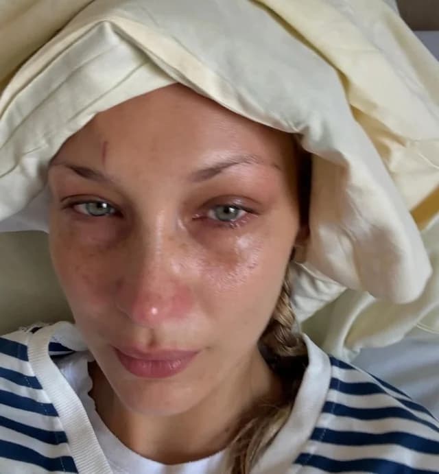 Белла Хадид: Фотографии из больницы вызвали беспокойство у поклонников