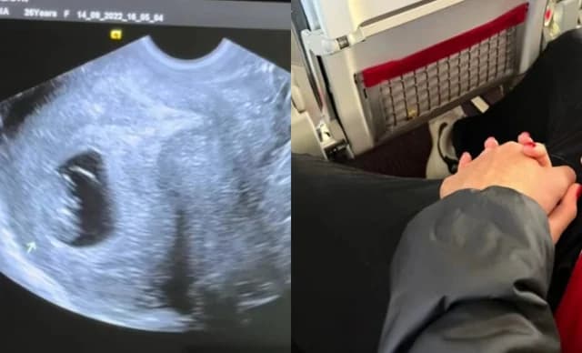 אספה פרדארי: משפיענית יוונייה פופולרית מכריזה על הריון ראשון