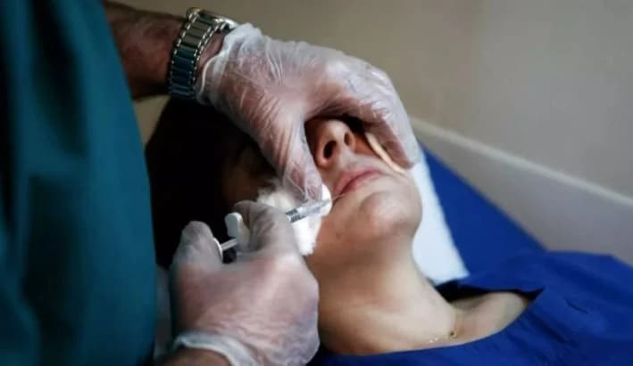 Risky Botox Parties in Cyprus: Complications and Concerns
