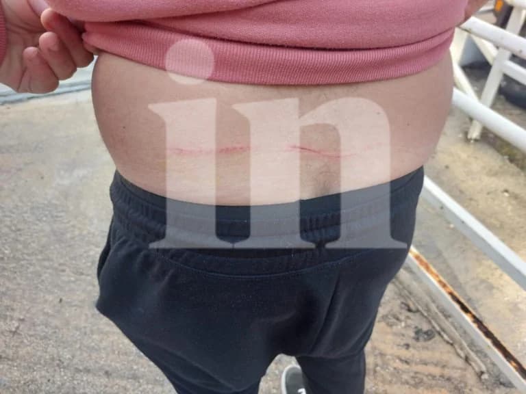 塔托伊发生狼袭击事件：男子受伤